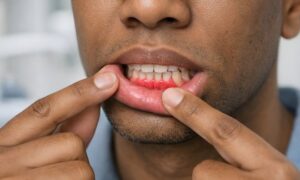 Dentist discussing periodontal gum health with a patient during an exam